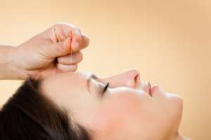 how acupuncture help to body 